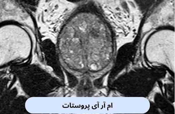 نمونه عکس ام ار ای زانو