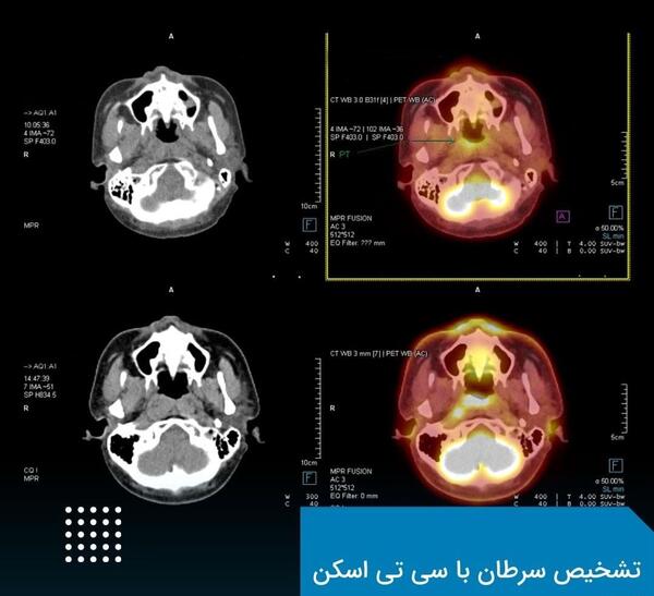 عکس ام ار ای رحم و تخمدان