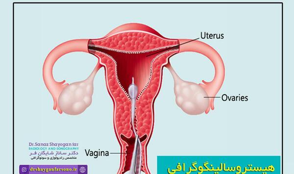 عکس ام ار ای رحم و تخمدان