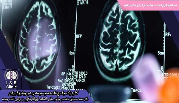 فرق ام ار ای با عکس رنگی