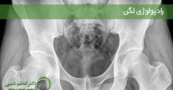 عکس ام ار ای دنبالچه سالم