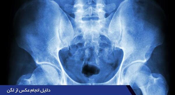 عکس ام ار ای دنبالچه سالم
