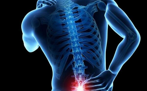 عکس ام ار ای دنبالچه سالم
