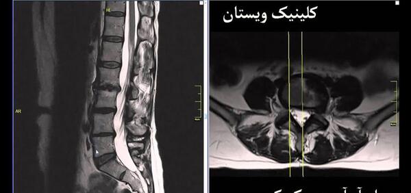 چگونه عکس ام ار ای گردن را بخوانیم