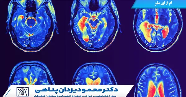 نحوه خواندن عکس ام آر آی مغز