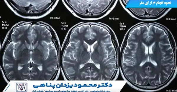 طریقه خواندن عکس ام ار ای مغز