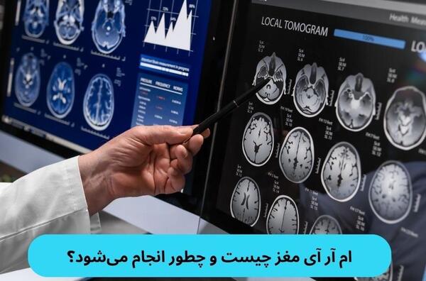 چگونه عکس ام ار ای مغز را بخوانیم