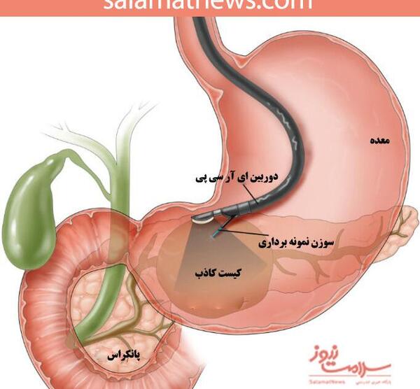 عکس ام ار سی پی چیست