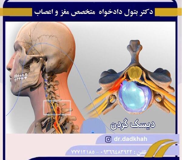 عکس ام ار ای پارگی دیسک گردن
