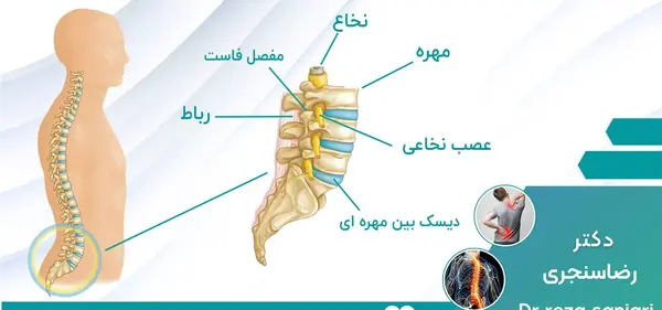 عکس ام ار ای پارگی دیسک گردن