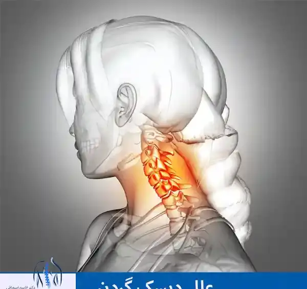 عکس ام ار ای دیسک گردن پاره