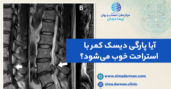 عکس ام ار ای دیسک گردن پاره