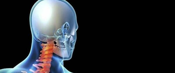 عکس ام ار ای دیسک گردن پاره