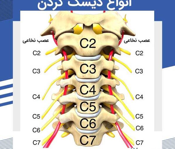 عکس ام ار ای دیسک گردن پاره