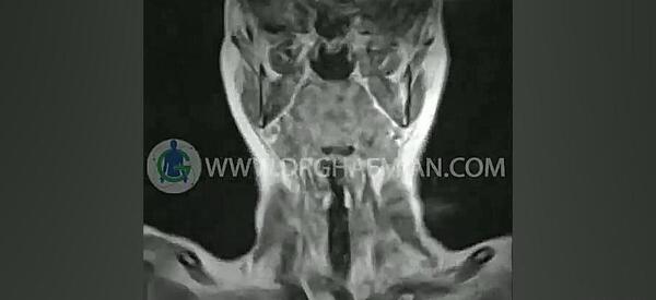 عکس ام ار ای دیسک گردن نی نی سایت