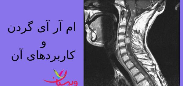 عکس ام ار ای از دیسک گردن