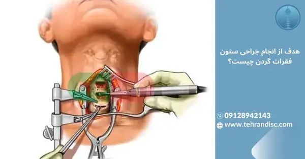 آرتروز گردن عکس ام ار ای دیسک گردن سالم