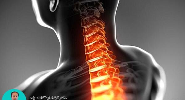 آرتروز گردن عکس ام ار ای دیسک گردن سالم