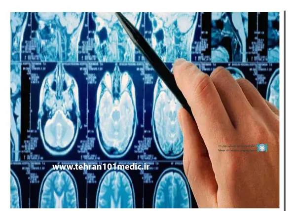 عکس ام ار ای مغز تومور دار