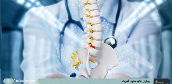 پارگی عکس ام ار ای دیسک کمر خفیف