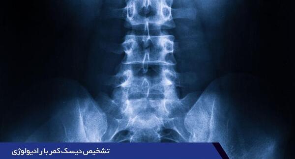 عکس ام ار ای از دیسک کمر