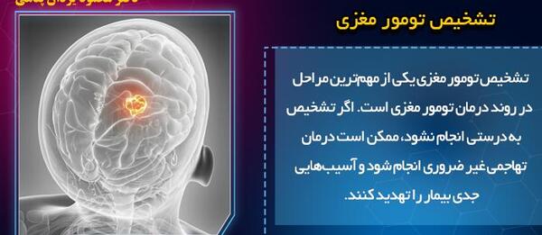 عکس تومور مغزی در ام ار ای