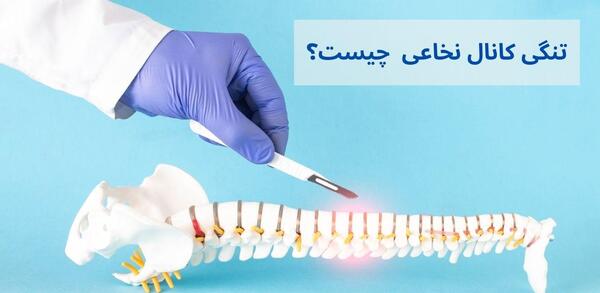 عکس ام ار ای تنگی کانال نخاع گردن