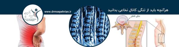 پارگی عکس ام ار ای تنگی کانال نخاع