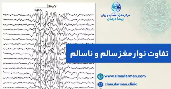 افسردگی عکس ام ار ای مغز سالم