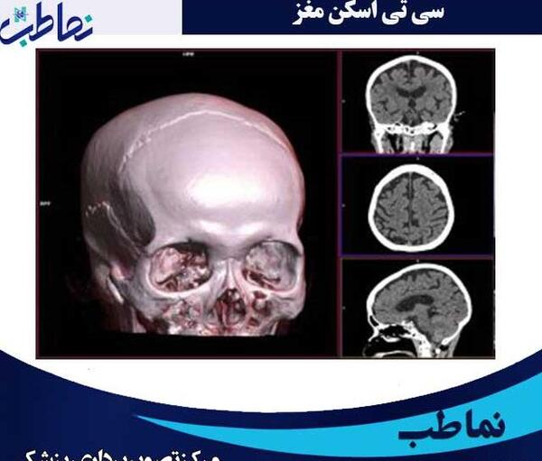 نمونه عکس ام ار ای مغز ناسالم
