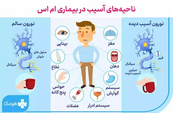 آم اس عکس ام ار ای مغز سالم