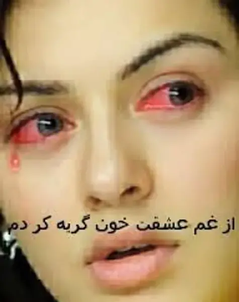 عکس گریه ویسگون