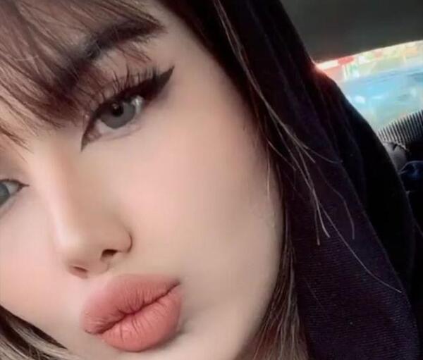 عکس چهره ویسگون