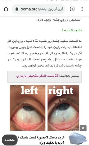 عکس حرف v در چشم زن باردار