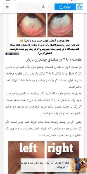 عکس حرف v در چشم زن باردار
