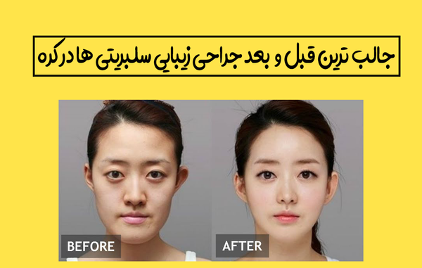 عکس جین قبل از عمل