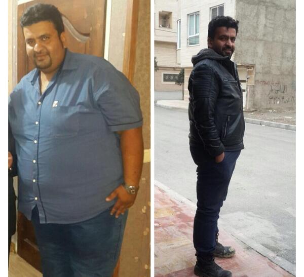 عکس جین قبل از عمل