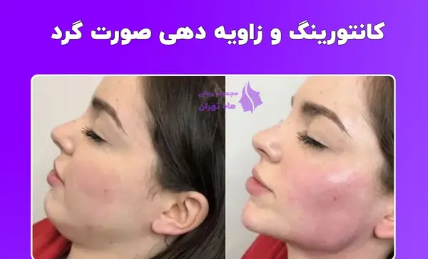 عکس زن با صورت گرد