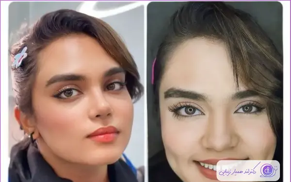 عکس زن با صورت گرد
