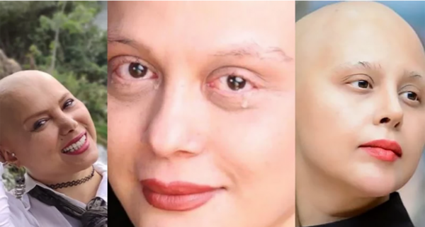 عکس زن ترسناک و مریض