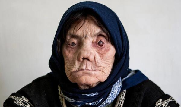 عکس زن ترسناک و مریض