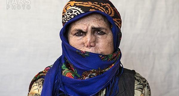 عکس زن ترسناک و مریض