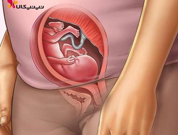 عکس زن باردار دوقلو