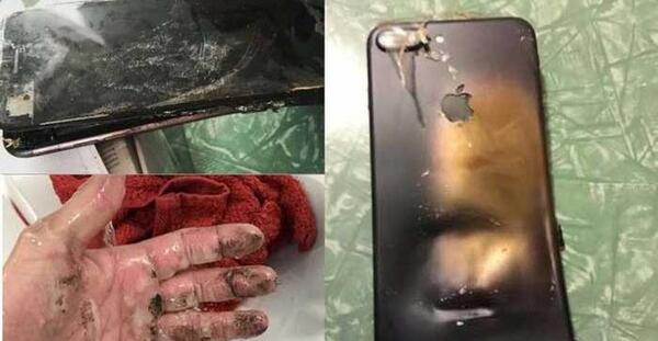 عکس انفجار گوشی در دست
