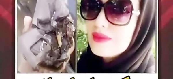 عکس ترکیدن گوشی تو دست