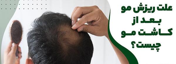 عکس مو کاشته شده