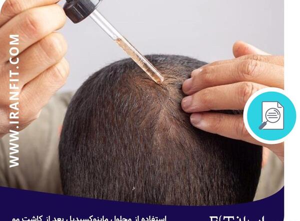 عکس کاشت مو بعد یک هفته