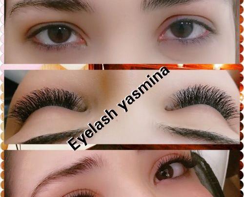 عکس کاشت هیدن مژه