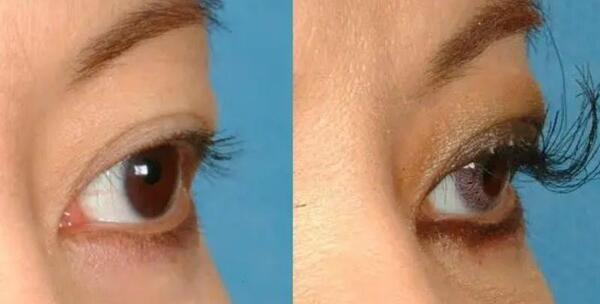 عکس کاشت مژه گیاهی