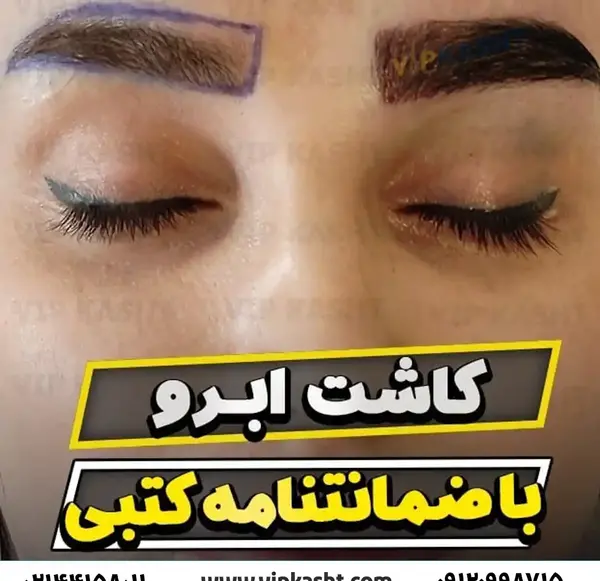 عکس ابرو کاشته شده